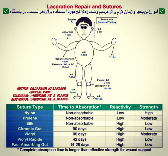 Sutures tip