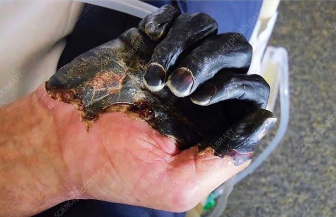 What's your diagnosis.