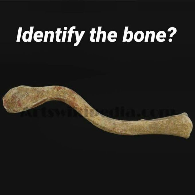 Identify the bone