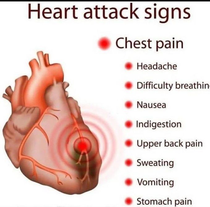 Heart attack signs