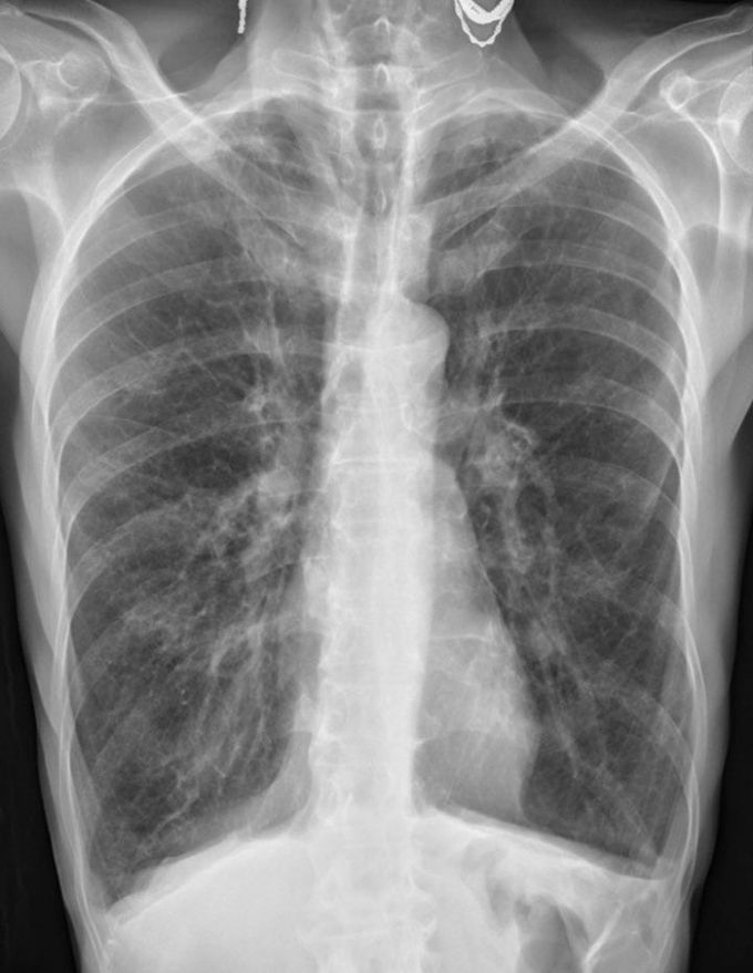 What is the diagnosis???