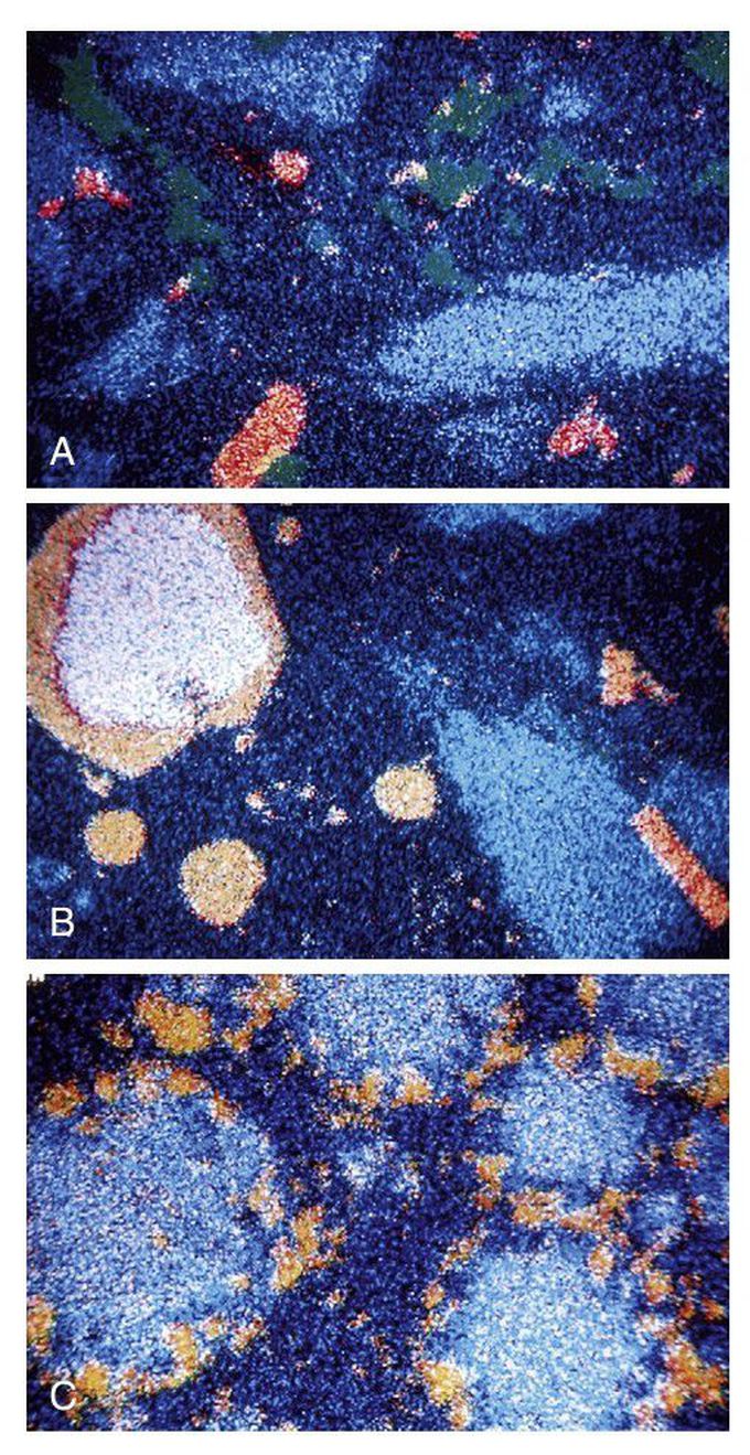 Microstructures of the set amalgams