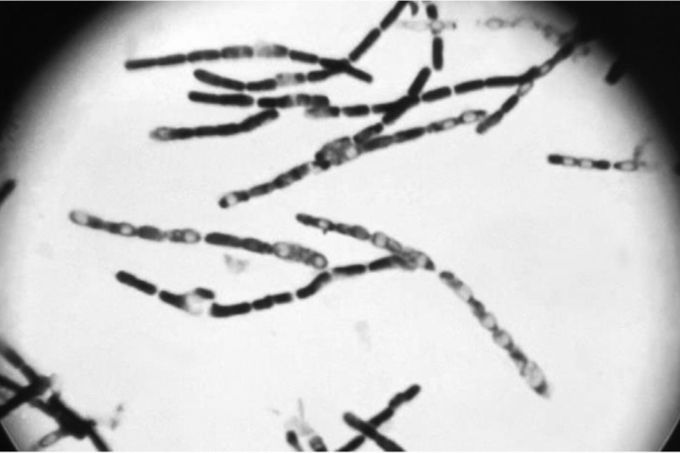 Medical microbiology question of the day