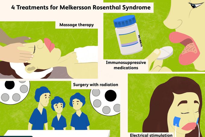 Treatment for Melkersson-Rosenthal syndrome