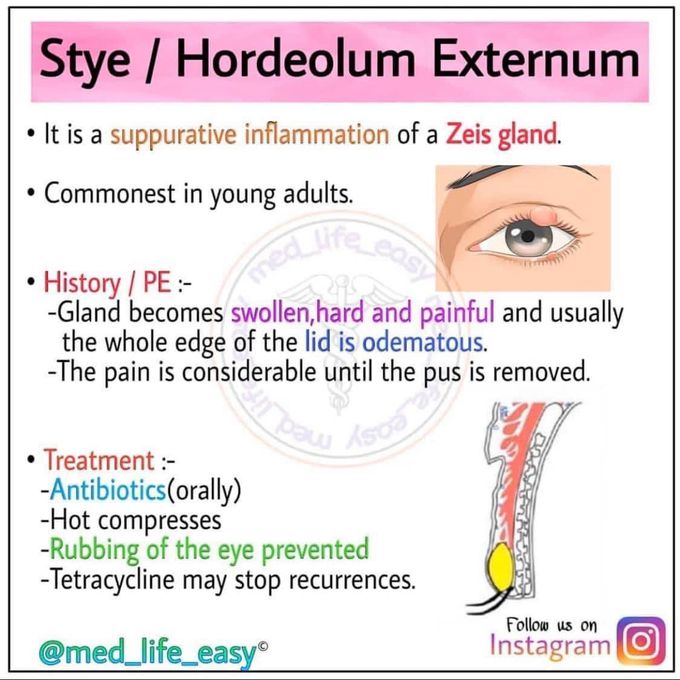 Zeis gland