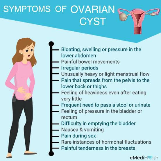 ovarian cyst stomach