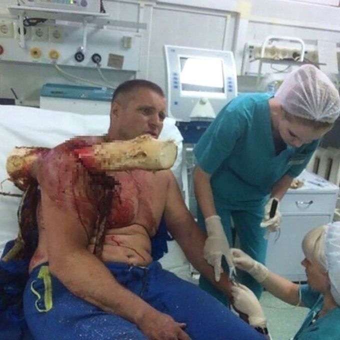 Injury 🤕.
