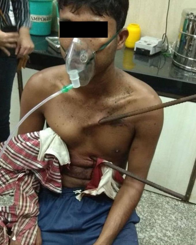 ⚠️Construction worker impaled by two iron rods, one inches from heart, miraculously survives! 