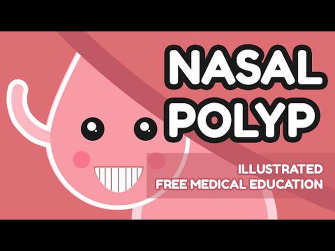 Short Introduction to Nasal Polyp