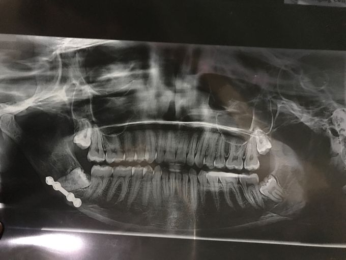 dental sugery