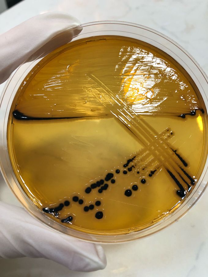 Black colonies of Salmonella group on Salmonella-Shigella agar