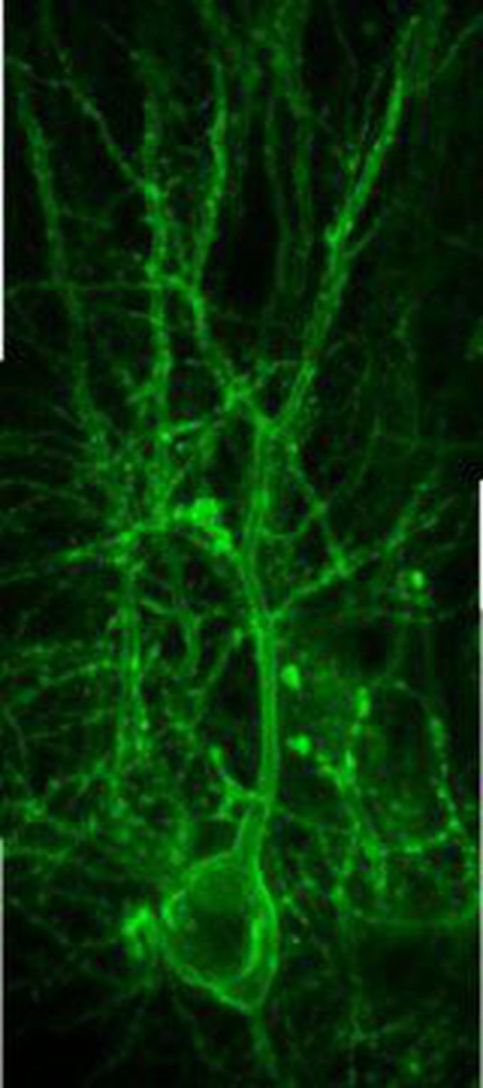 Scientists have developed a way to see brain cells talk -- to actually see neurons communicate in bright, vivid color. The new lab technique is set to provide long-needed answers about the brain and neurological diseases such as Alzheimer's disease, schizophrenia and depression. Those answers will facilitate new and vastly improved treatments for conditions that have largely resisted scientists' efforts to understand them