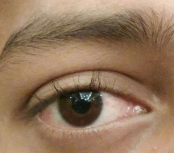 What is your diagnosis?
