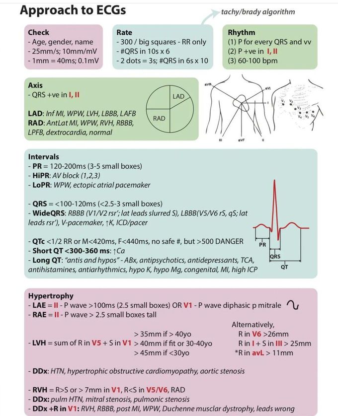 Approach to ECG