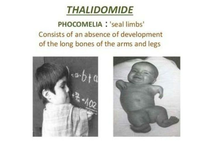 Thalidomide