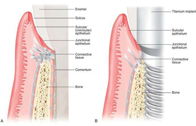 Tooth and dental implant