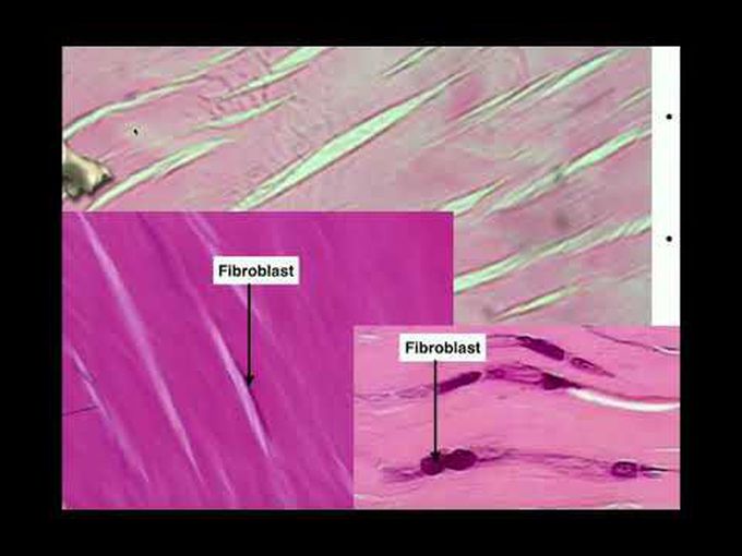Identification Video of Connective Tissue-II