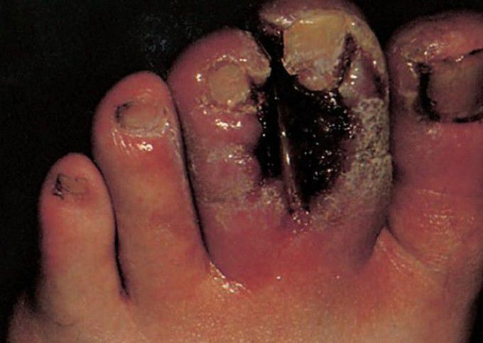Diagnosis?