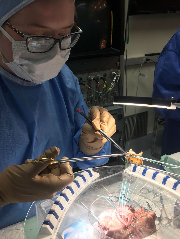 Aortic valve replacement