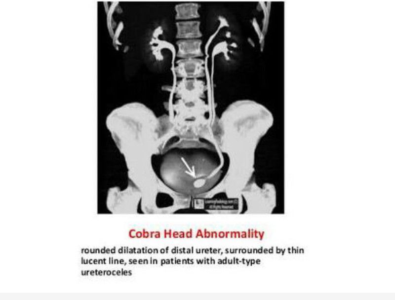 COBrA-CT