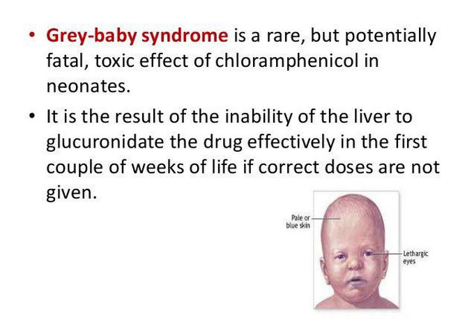 Grey baby syndrome.