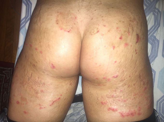 What’s case does this looks like?