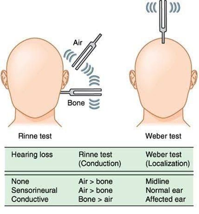 EAR TEST