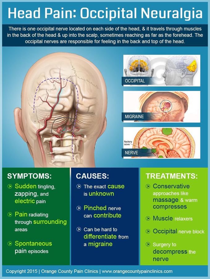 Occipital neuralgia