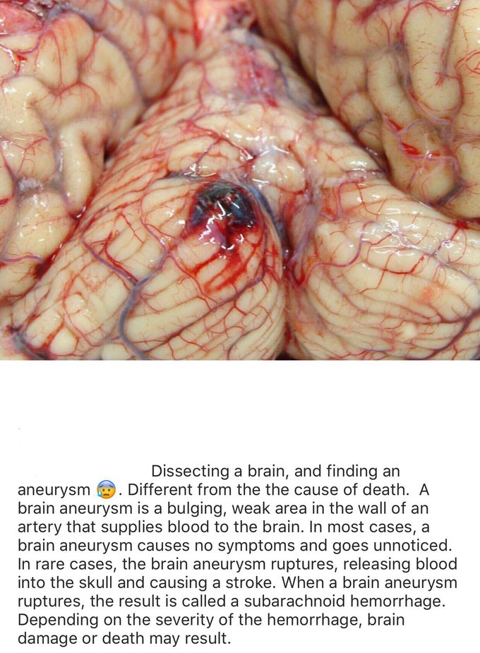 Neurology