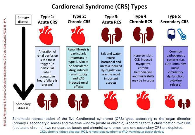 Cardiorenal syndrome - MEDizzy