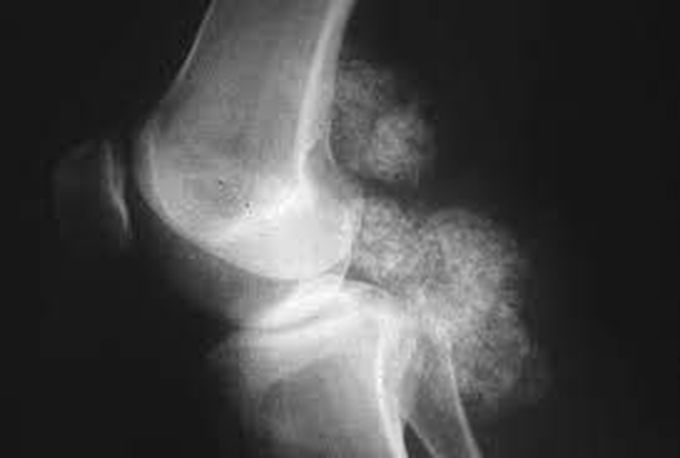 Diagnosis and treatment??