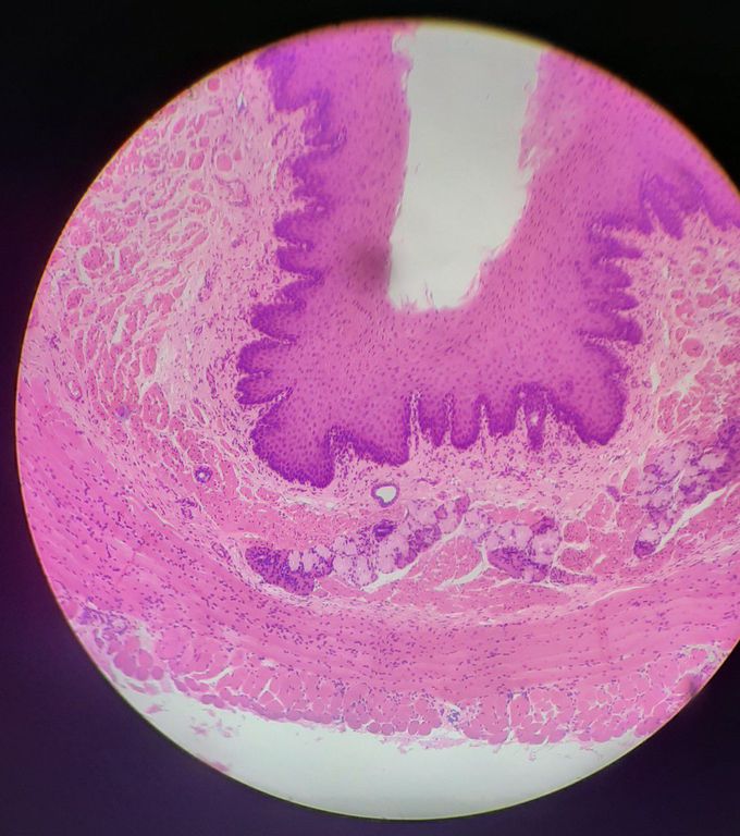 Esophagus