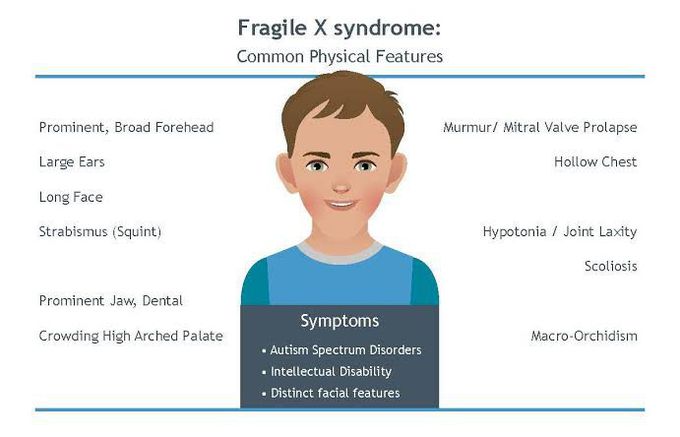 Causes of fragile X syndrome