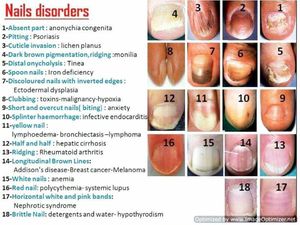 Nails disorders - MEDizzy