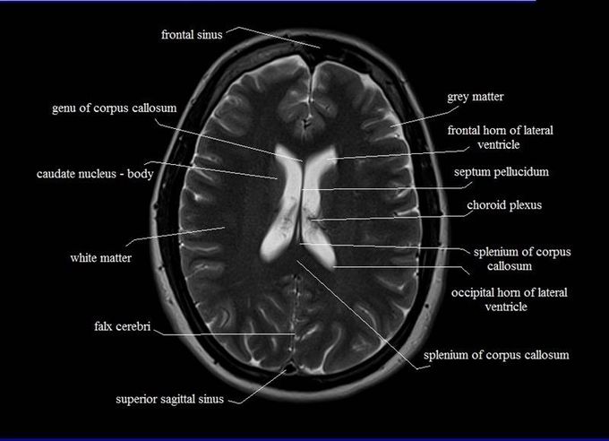 Matters of brane