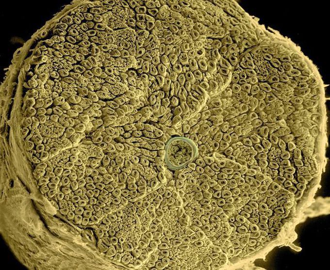 Spinal Root Nerve