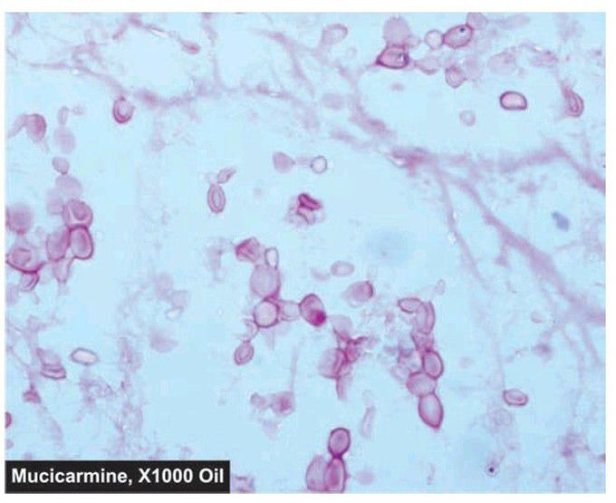 Cryptococci