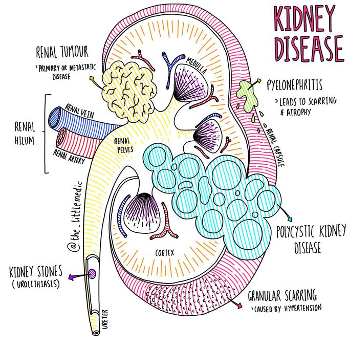 Kidney Disease