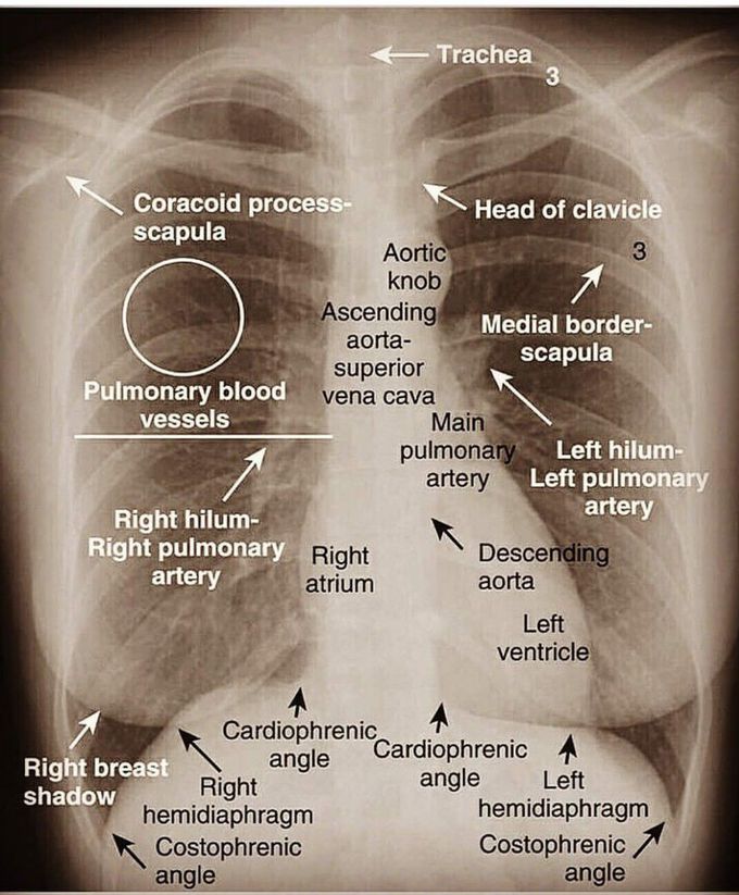 X ray diagnosis - MEDizzy