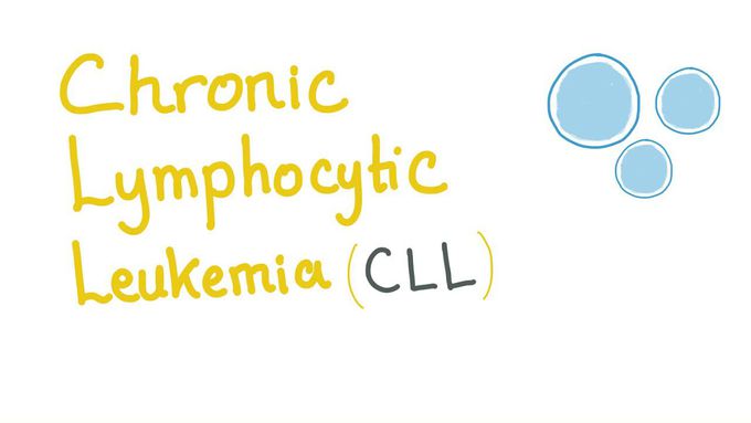 Chronic Lymphocytic Leukemia (CLL)