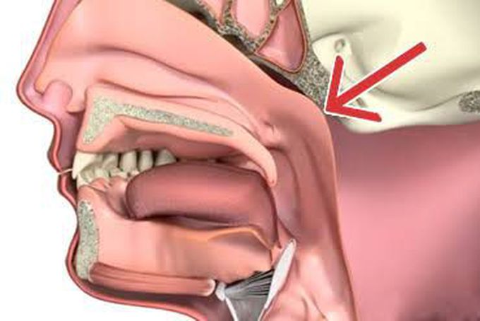 Symptoms of nasopharyngeal carcinoma