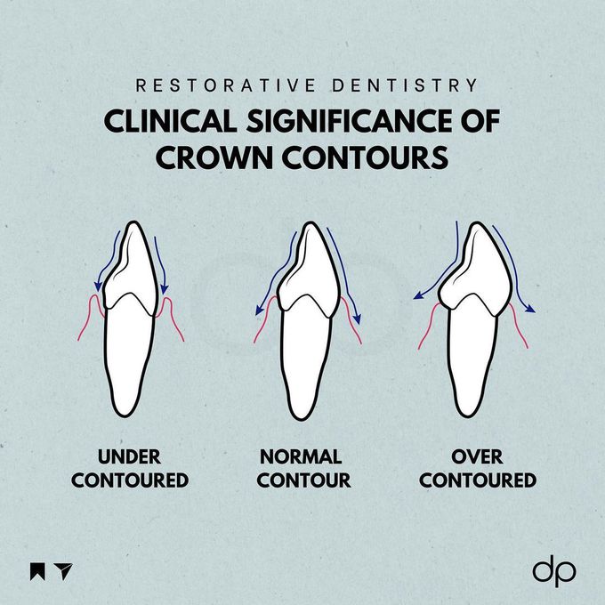 Significance of crown contour