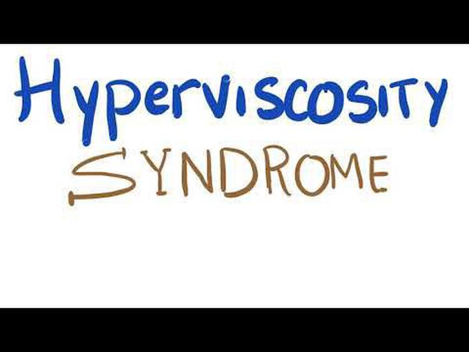 Hyperviscosity Syndrome