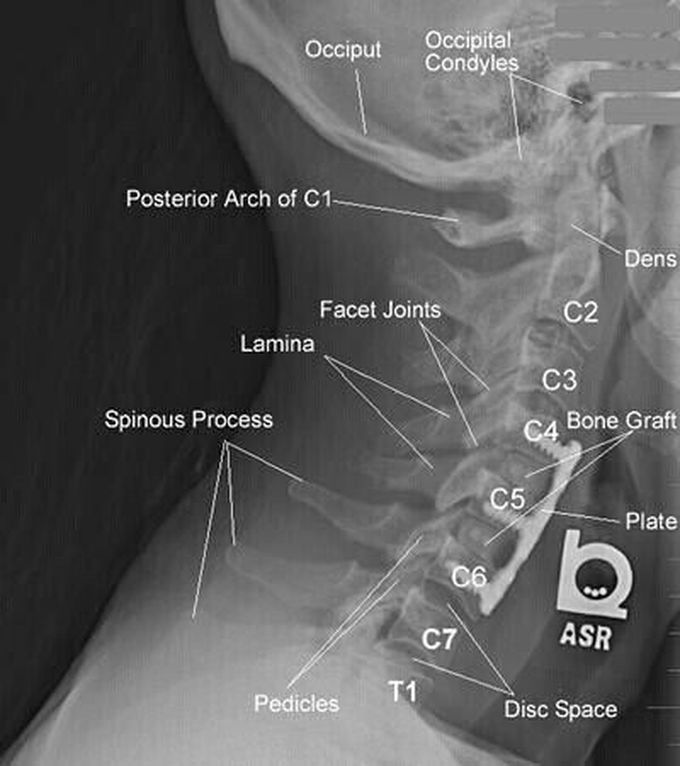 Anatomy
