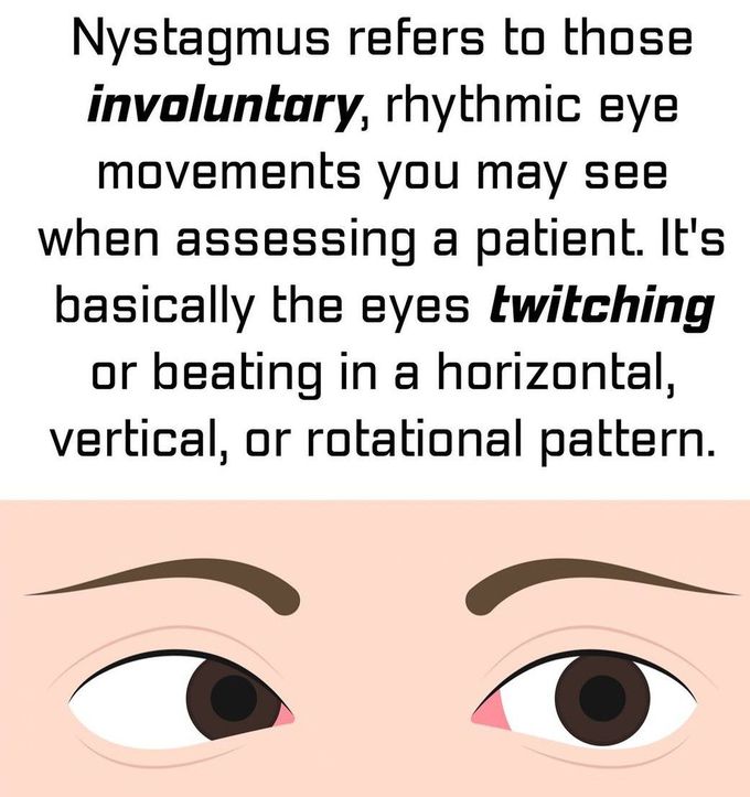 Nystagmus I