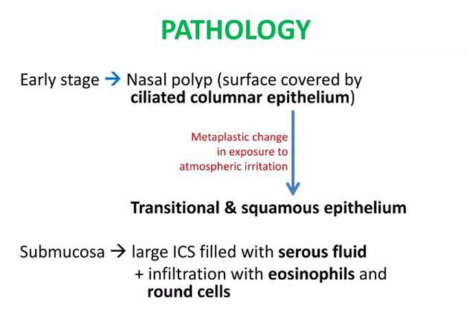 Nasal polps-Pathology