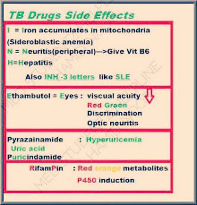 Tuberculosis