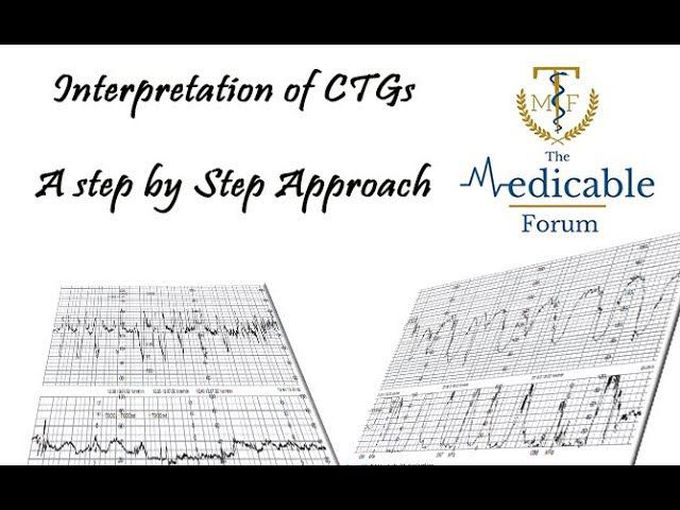 Interpretation Of Cardiotocography (CTG)