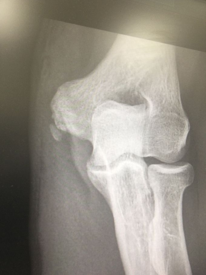 What is diagnosis?!??