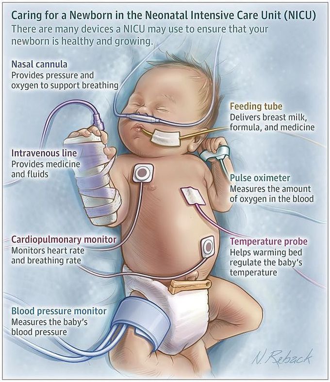 Care of Newborn